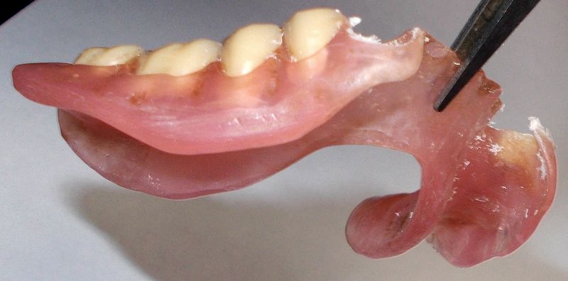 dentiera resina DSCN6442_2.JPG